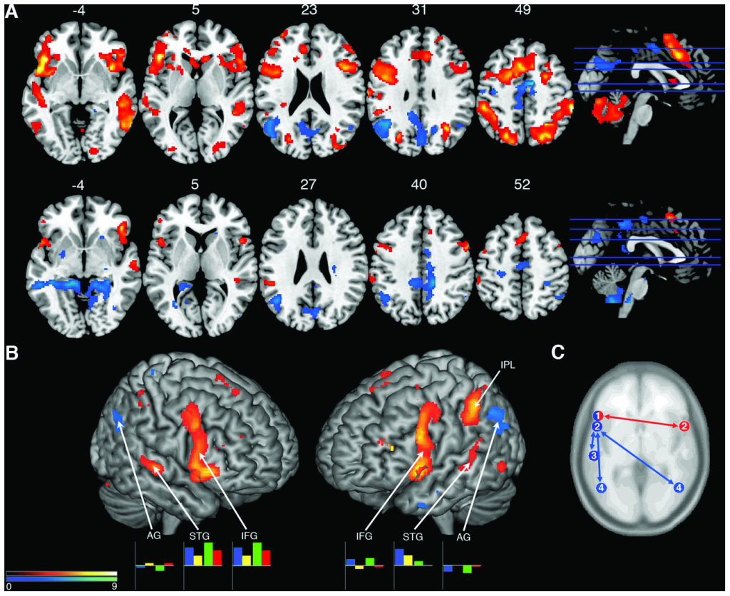 Jazz musician brains visualization of neuroimaging results_0