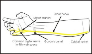 Brain Hacking is Electric! – NW NOGGIN: Neuroscience outreach group ...