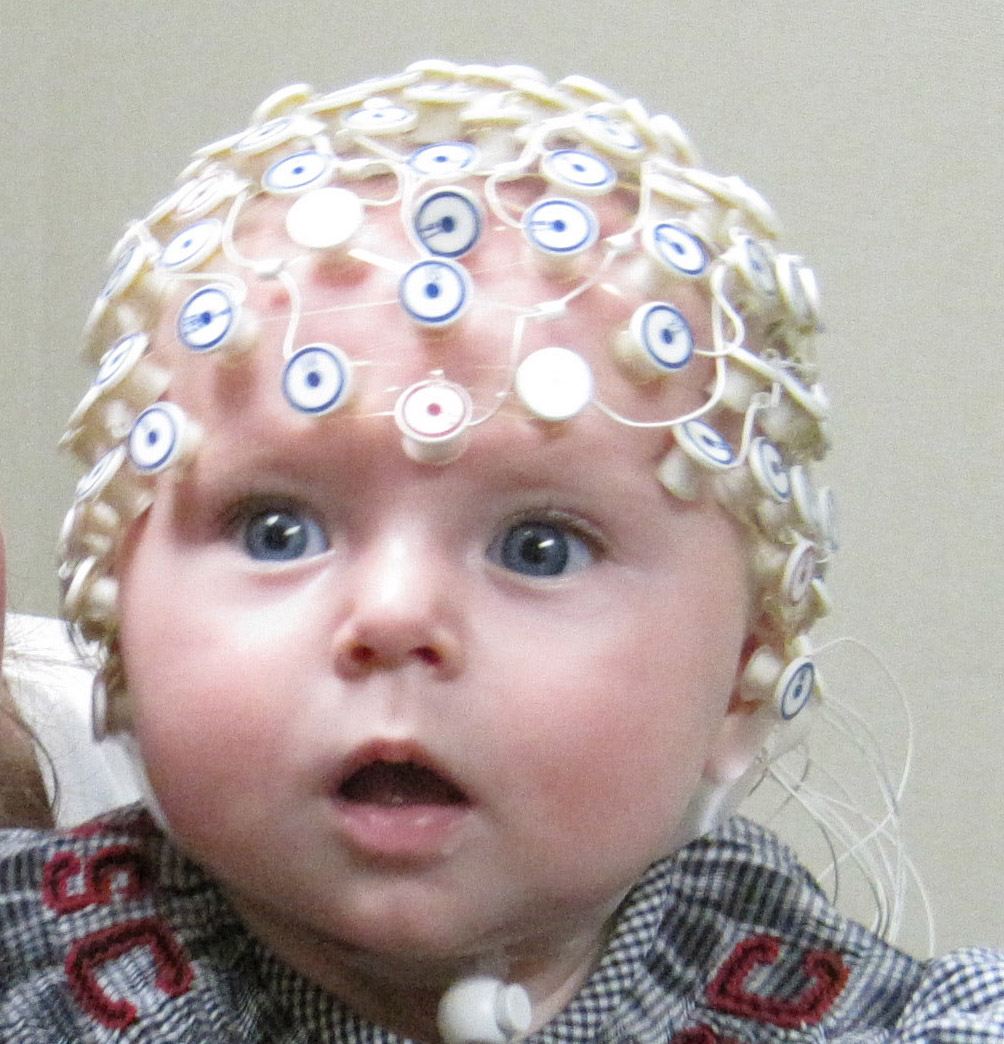 Ээг фото. Электроэнцефалография (ЭЭГ). Электроэнцефалография головного мозга (ЭЭГ). ЭЭГ детям. Шапочка для ЭЭГ для детей.