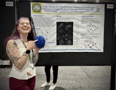 Noggin Bonks and Neurogenesis