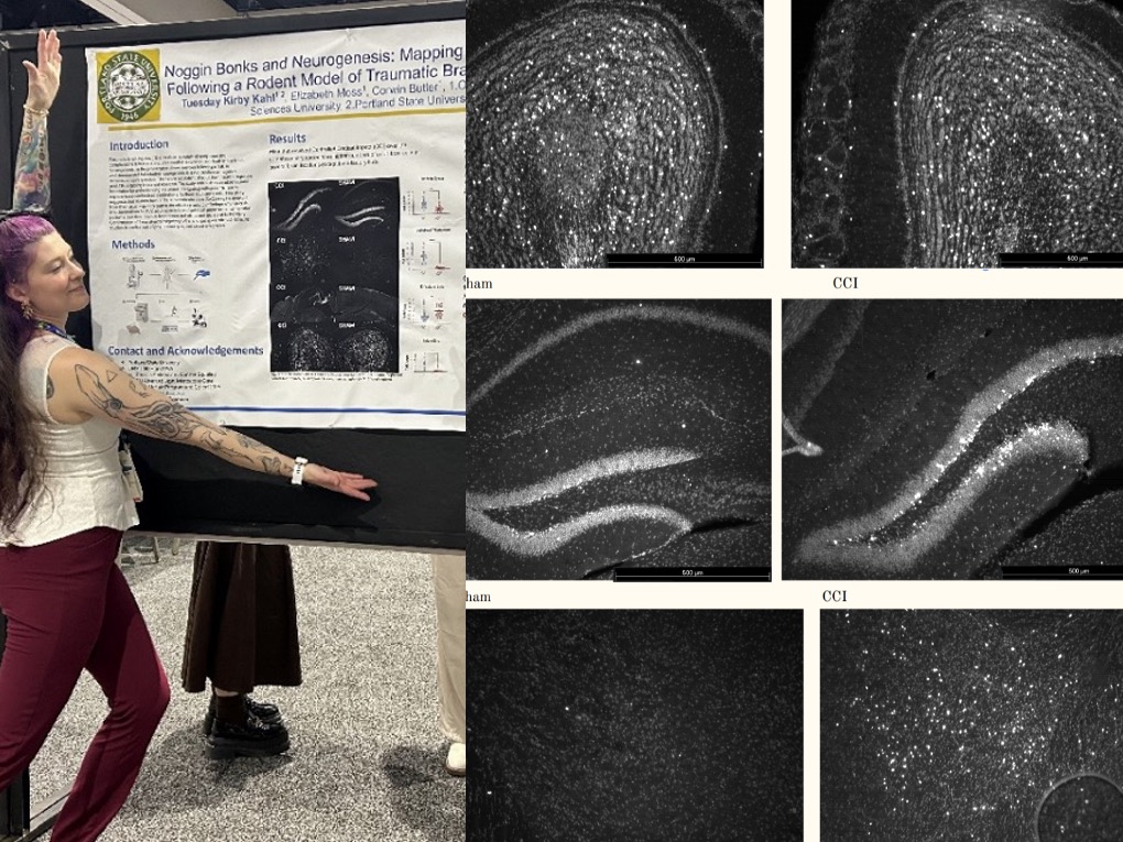 Noggin Bonks and Neurogenesis